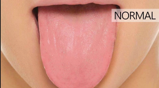 8 sinais que sua língua dá sobre sua saúde